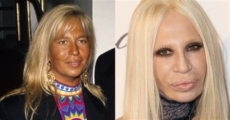 donatella versace antes e depois|donatella versace hair.